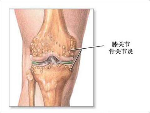 ϥ�P(gu��n)��(ji��)